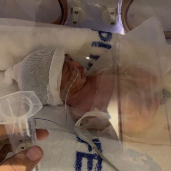 I Wasn’t Just Pregnant, I Was Dying From Preeclampsia.