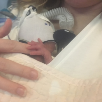 My Story With Hellp Syndrome